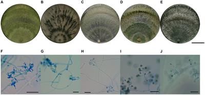 Beneficial and biocontrol effects of Trichoderma atroviride, a dominant species in white birch rhizosphere soil